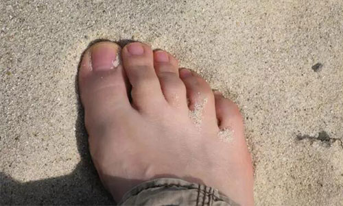 ������ô���� ��������Ӧע��������